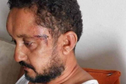  اعتداء أمني على صحفي في تونس