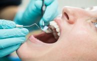 أطباء الأسنان التعريفة في المستشفيات العمومية