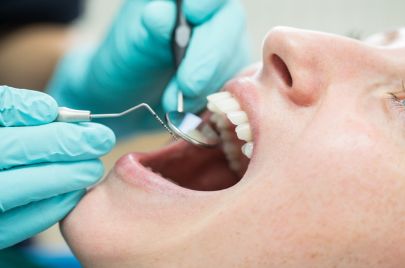 أطباء الأسنان التعريفة في المستشفيات العمومية